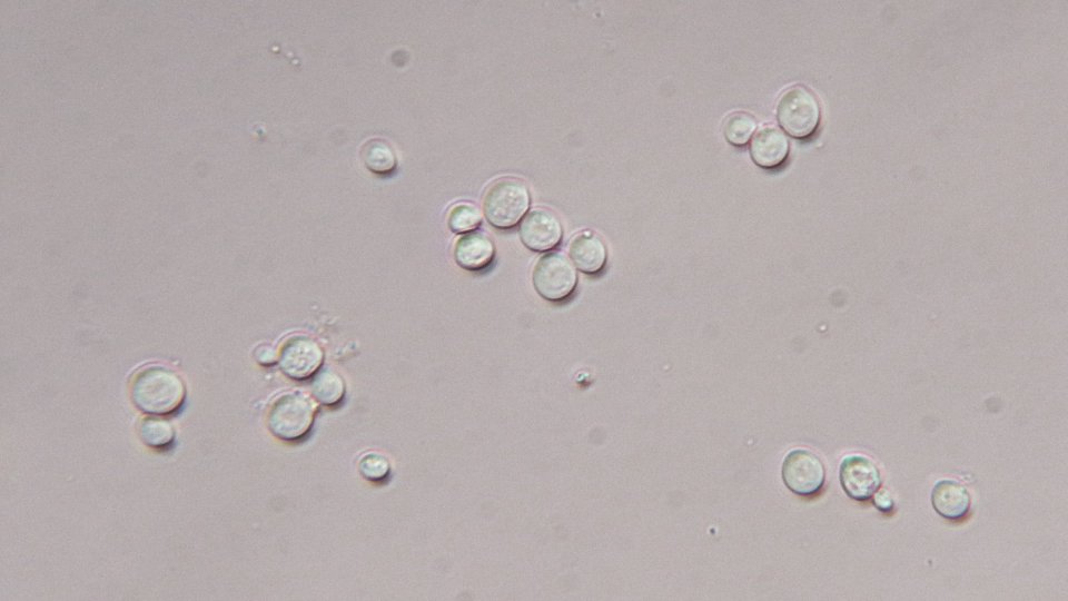 40x phase contrast objective with oblique ring in condenser