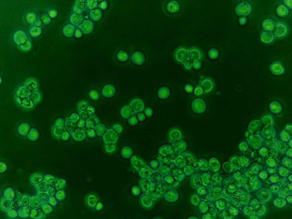 motic 40x na.0.65 finite phase contrast yeast