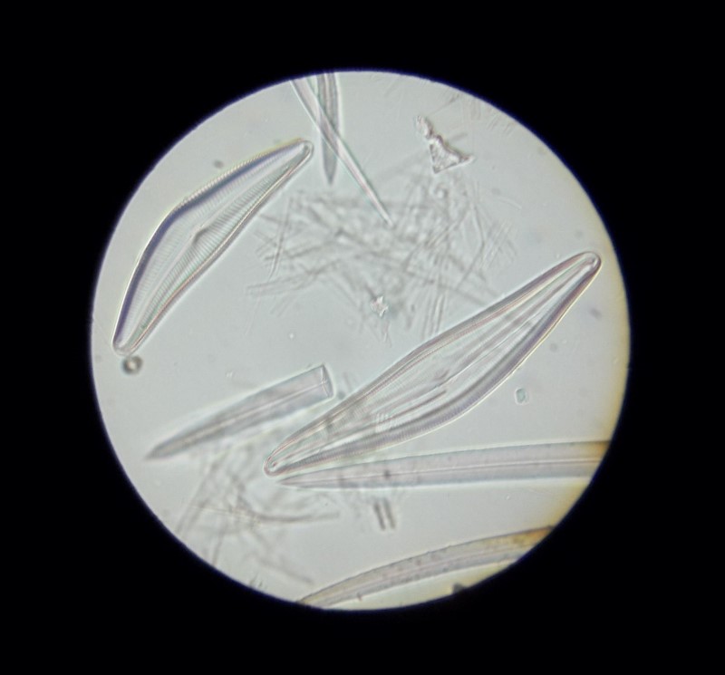 diatom slide, taken with the 60X objective or as Leitz designates it a #7, with no N.A. qualification.
