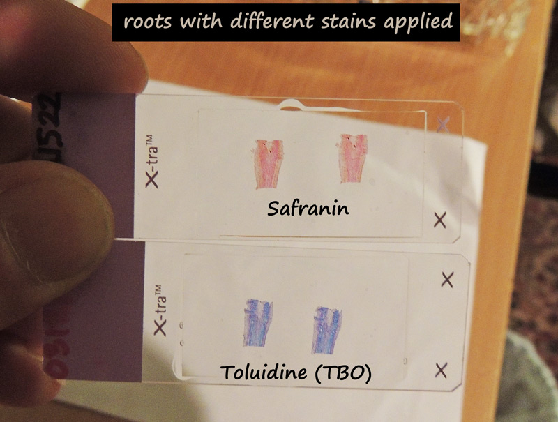 ws_tbo_safranin_stained_com.jpg