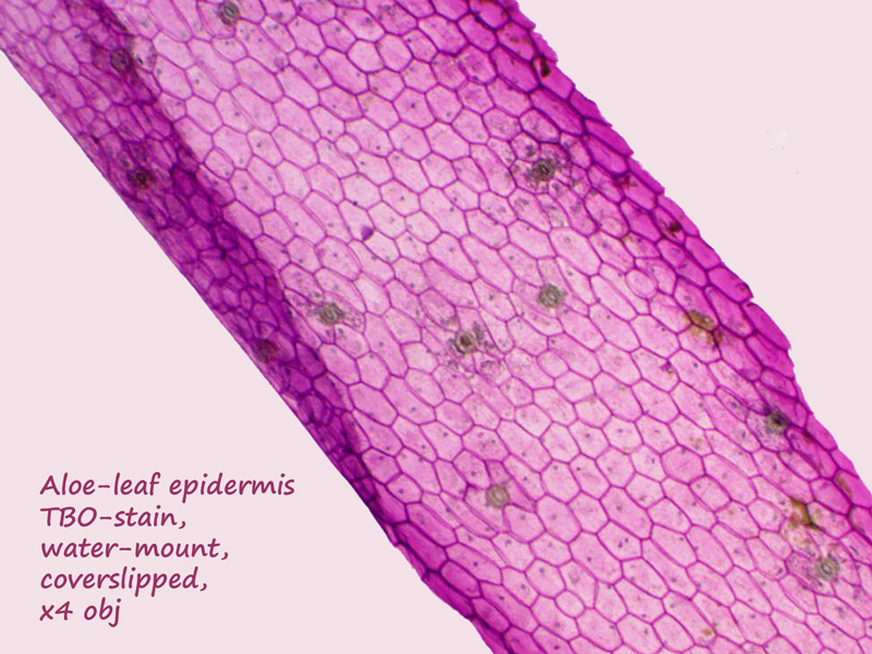 ws_aloe_epidermal_peel_x4.jpg