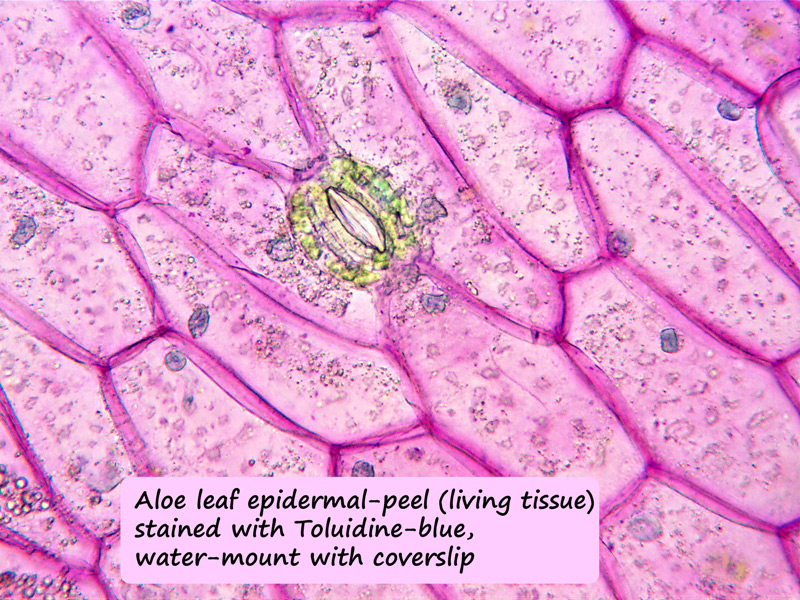 ws_aloe_epidermal_peel_1.jpg