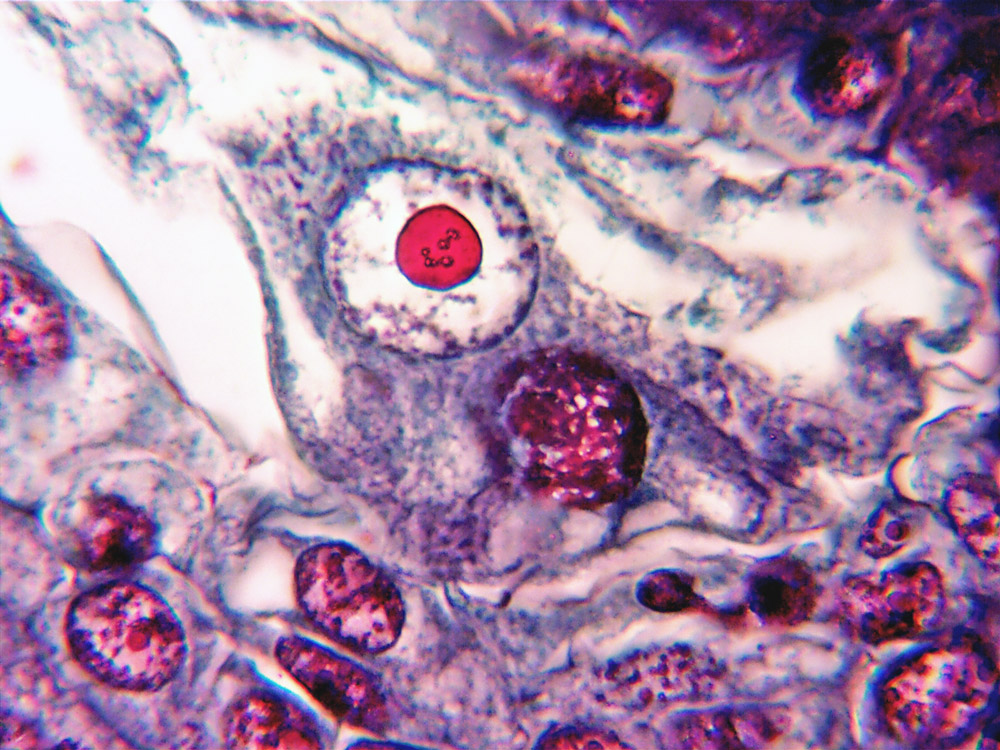 ws-ovule-stacked.jpg