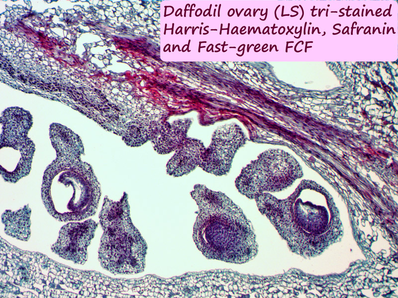 ws-tri--stain-1.jpg