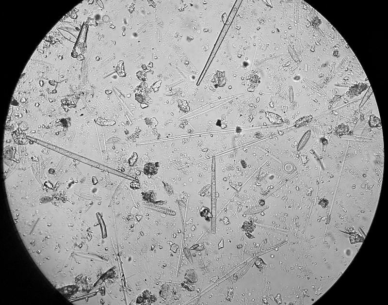 Diatom View 1.jpg