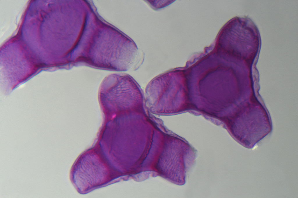 2016-07-28 evening primrose pollen 40x 1024px.jpg