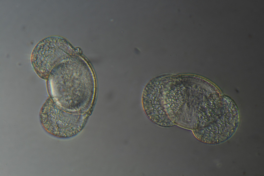 2016-07-27 pine pollen 40x 1024px.jpg