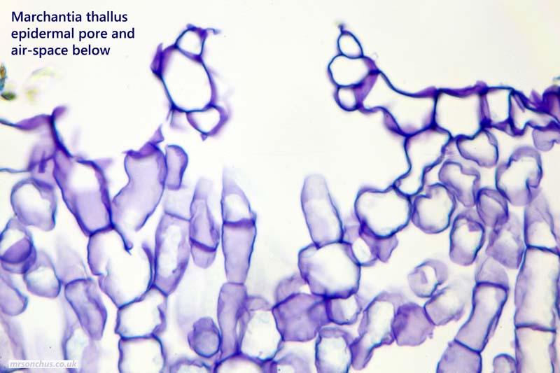 Good contrast and definition of a pore in TS - Toluidine-blue triumphs!