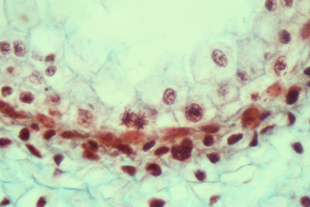 18_03_201620_43_020001LateTelophaseOrMeiosis1024_small.jpg