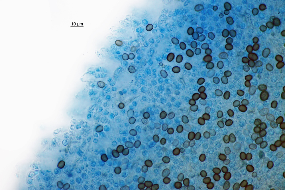 Spores on gill surface,stained with LPCB