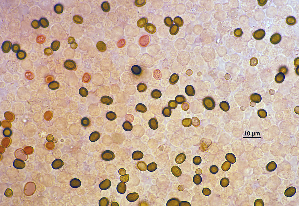 Spores on gill surface,stained with Congo Red