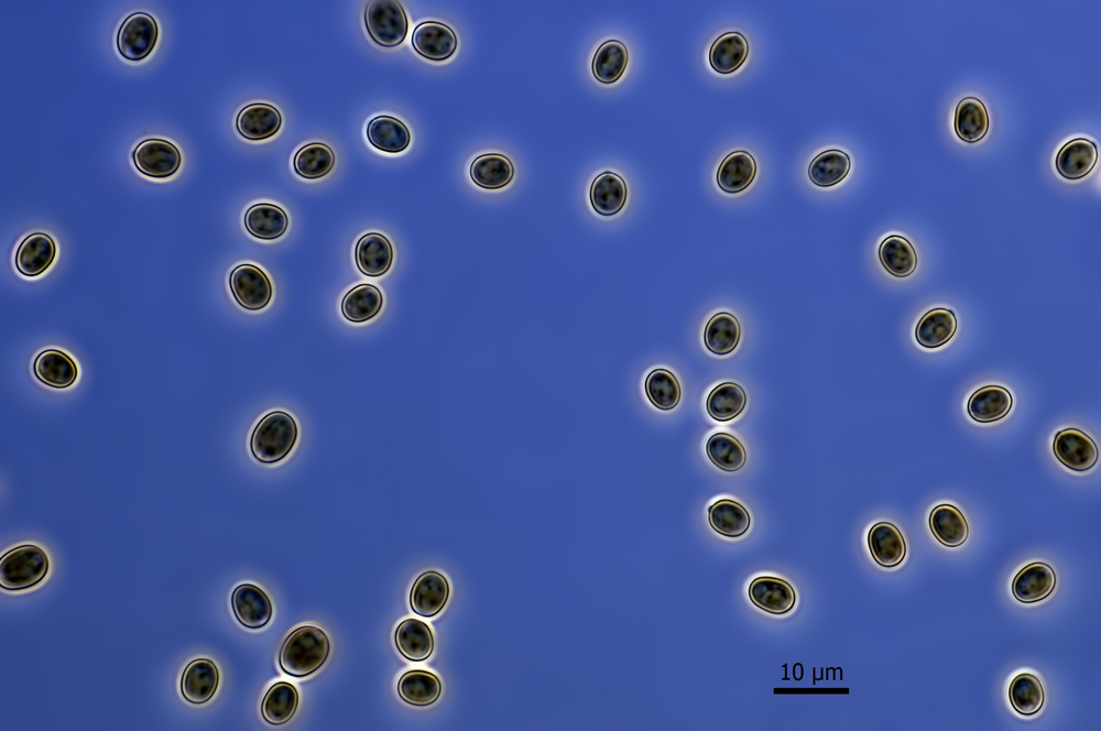 Spores,phase contrast 630x