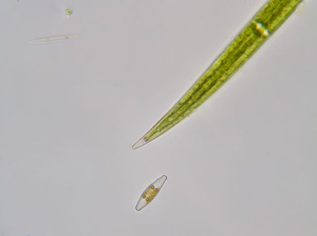 Closterium & Diatom.jpg