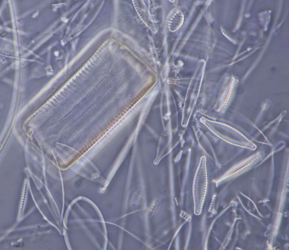 Single frame strew diatoms 1.jpg