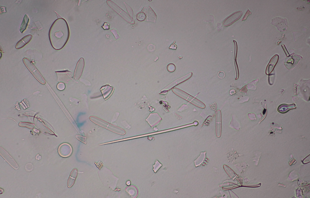 pin_diatom.JPG