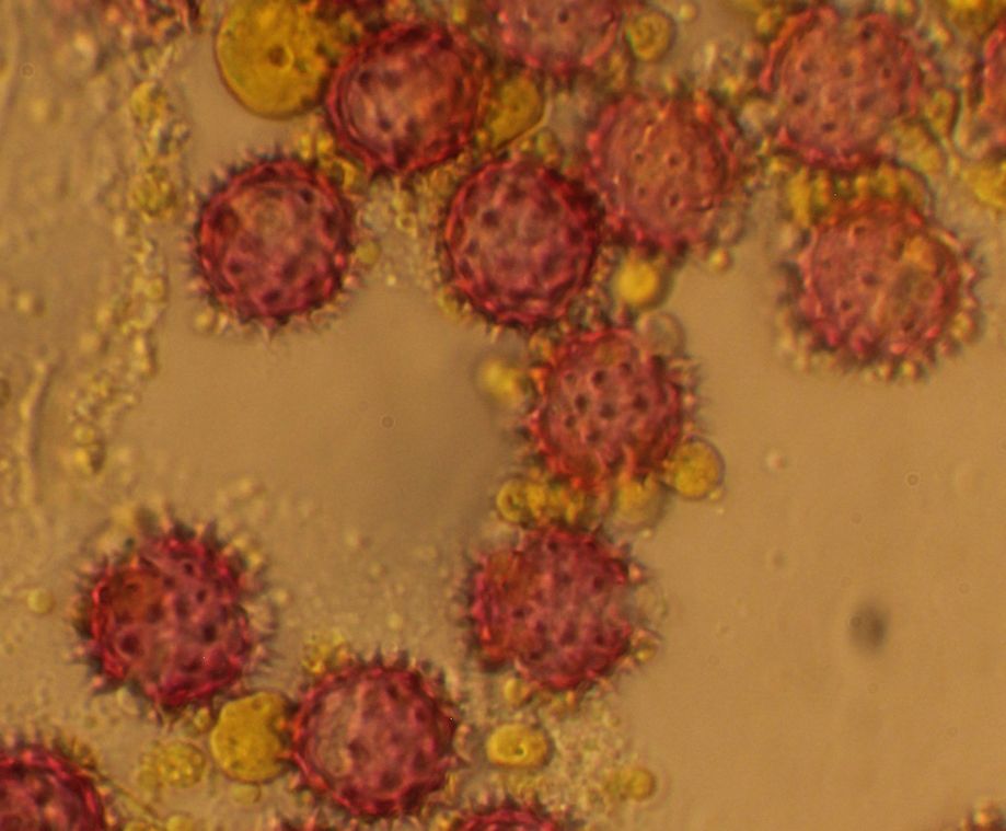 pollen(solidago)1.jpg