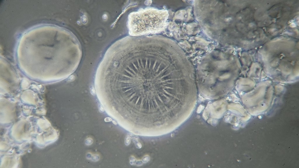 Starch grain captured in the midst of expanding in an oddly symmetrical manner. Usually they split in the middle and develop a very irregular central cavity. about 50 um. Bright M phase