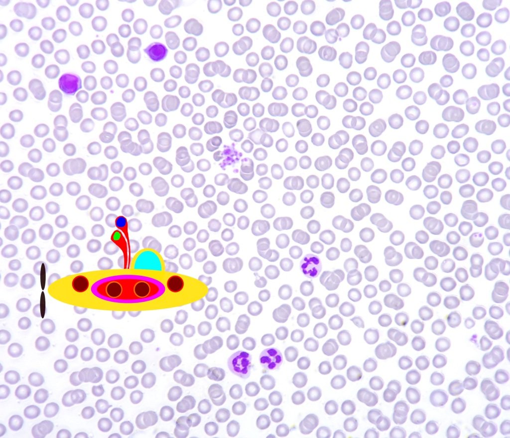 Blut Pappenheim 40er Apo gestackt groß ohne Beschriftung mit Krankheitserreger 1024.jpg