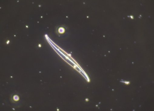 diatom dry, bare slide, 40X0.75.JPG