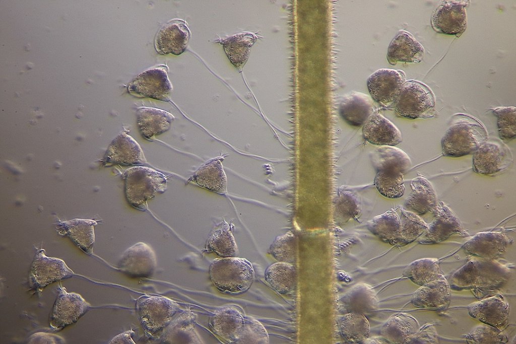 Colony of Vorticella.jpg