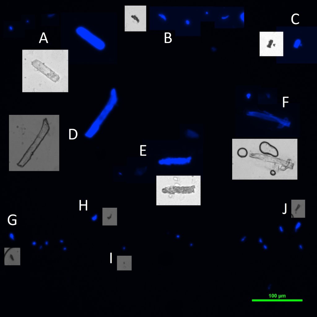 &quot;Check those corners&quot; &quot;Steady people, let finish our sweep&quot;<br />&quot;We are still MicrobeHunters??!!, and we got a job to do&quot;<br />&quot;Movement&quot;&quot;What is the position&quot; &quot;Ergh..Can't lock in&quot;<br />&quot;Multiple signals&quot; &quot;They are closing!&quot;<br />&quot;Go UV? people&quot; &quot;Look Sharp&quot; &quot;I got signals I got readings, in front and behind&quot;<br />&quot;Tracker is off the scale, man&quot;<br />&quot;They are all around us, man!&quot;<br />&quot;Maybe they don't show up on UV? at all&quot;<br />&quot;Maybe we got them demoralized&quot;