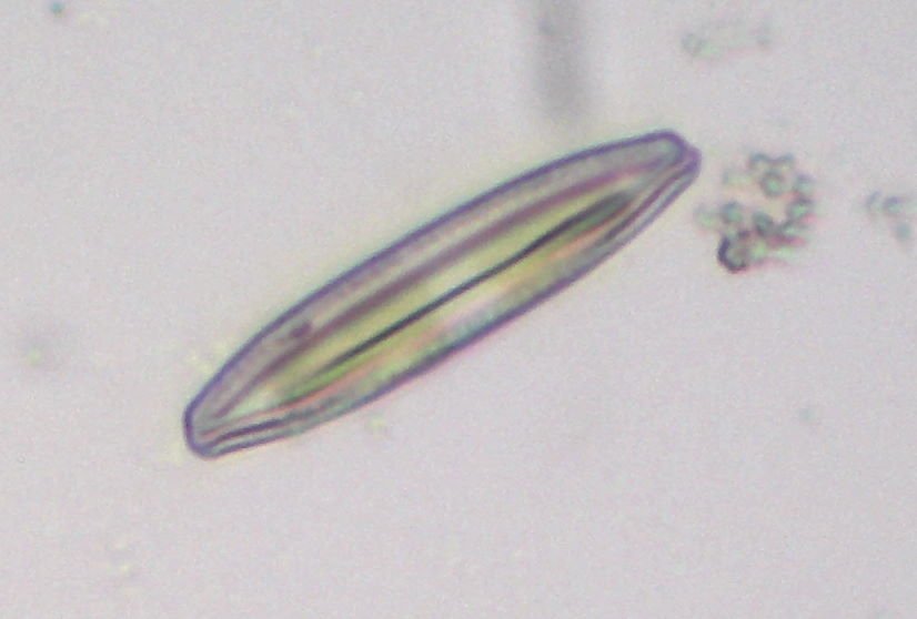 Diatom4_Toup_40xG38Crop.jpg