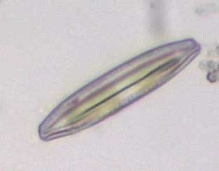 Diatom4_Toup40x50pcCrop.jpg