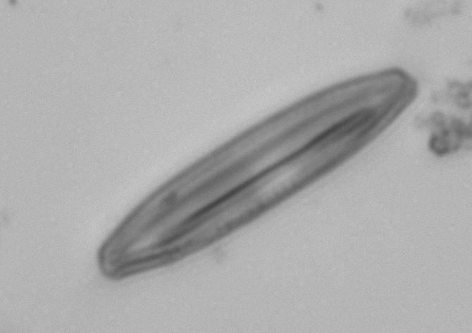 Diatom4_178m_40x_00001Crop.jpg