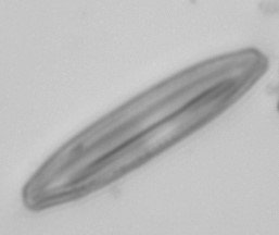 Diatom4_178m40x_00001_50pcCrop.jpg