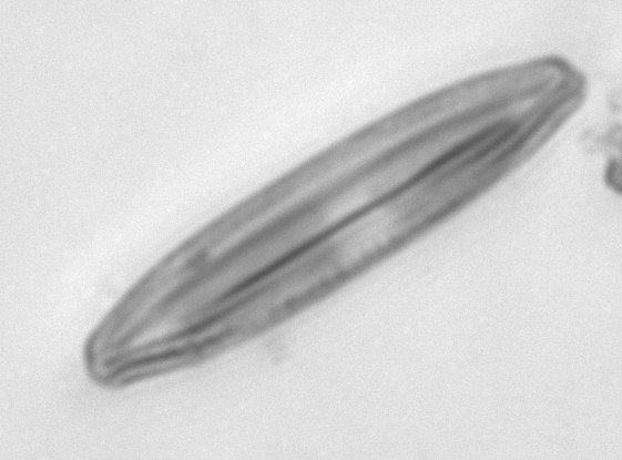 Diatom4_178m40x486nm_00002Crop.jpg