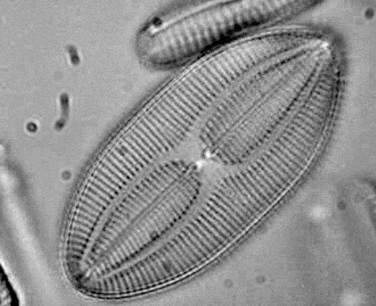 Louisediatom.jpg