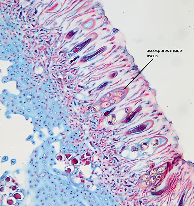 2micron lichen section (2)_stitch.jpeg