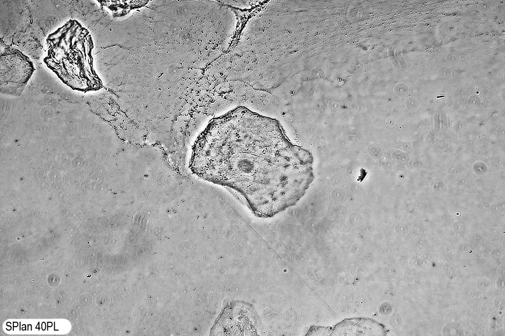 splan40x cells.jpg