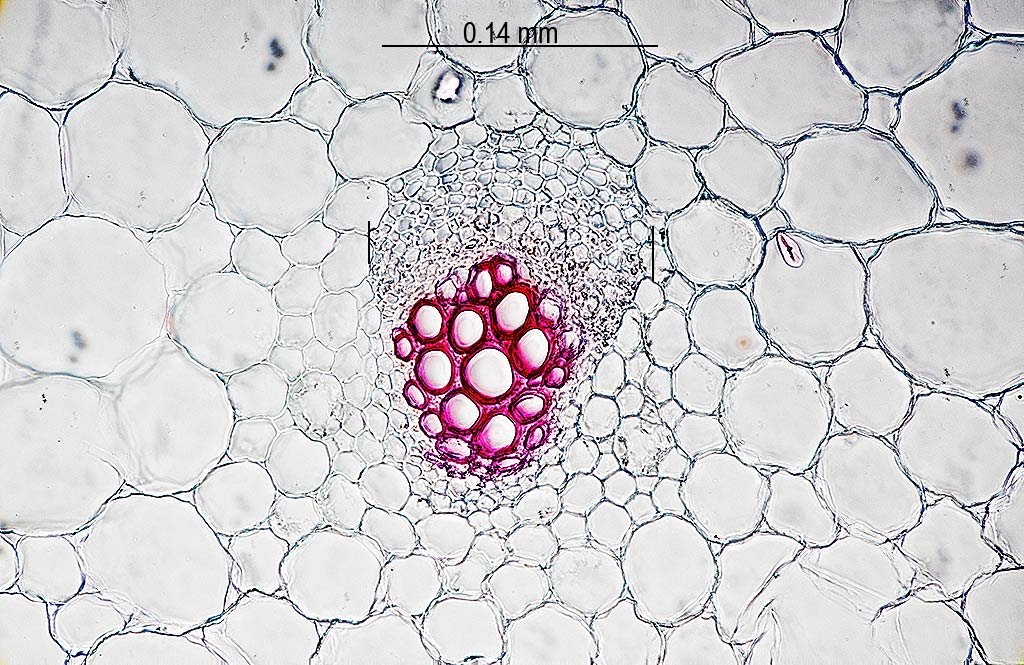 24iii21 carrot xylem.jpg