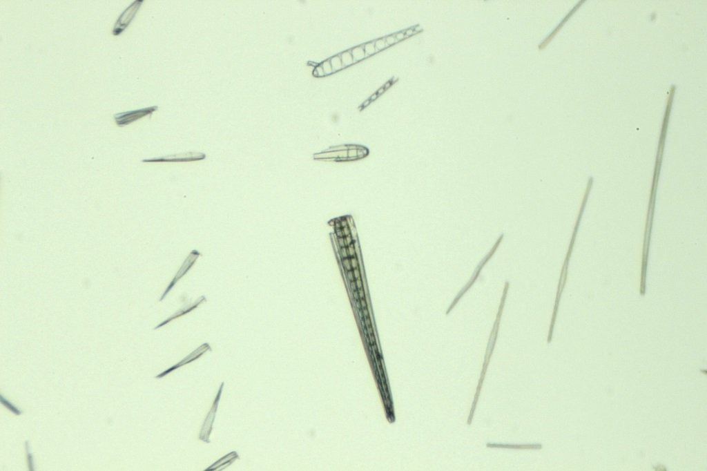 Spain Diatoms9.jpg