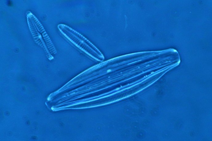 Stack of phase contrast images of a marine diatom.jpg