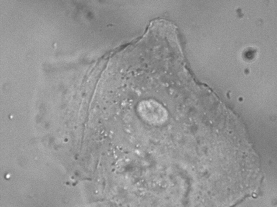 06 avril cheek cell BF.jpg