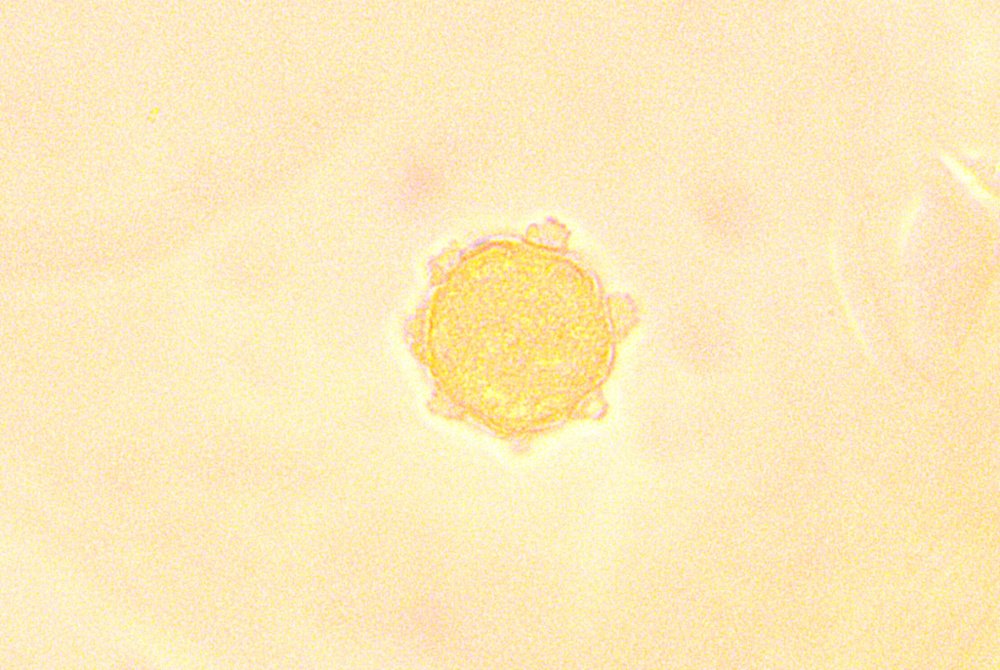 Stellaria_pollen2.jpg