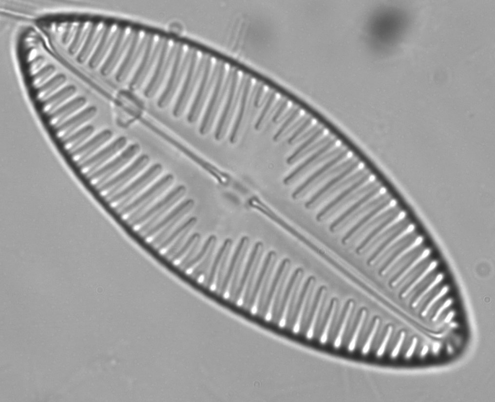 F100 Med Diatom _Crop_77pc_00001.jpg