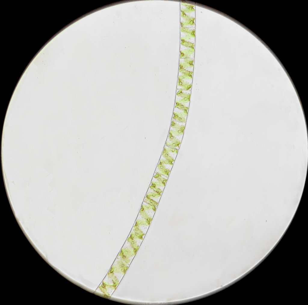 Spirogyra.jpg