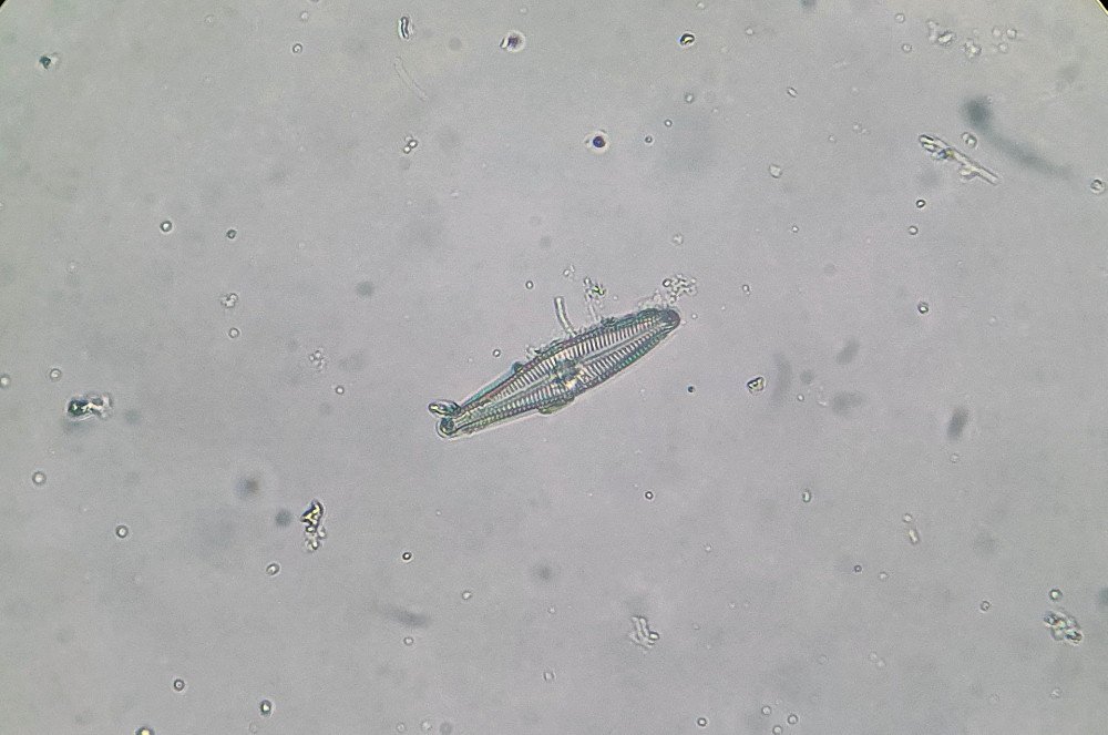 Diatom 02.jpg