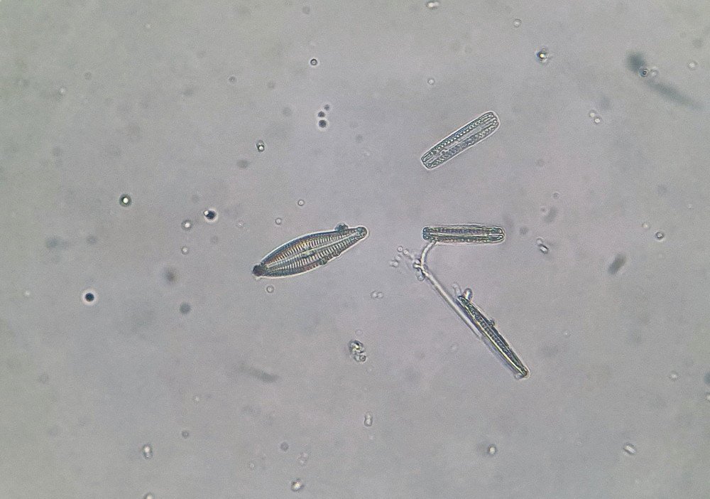 Diatom 03.jpg