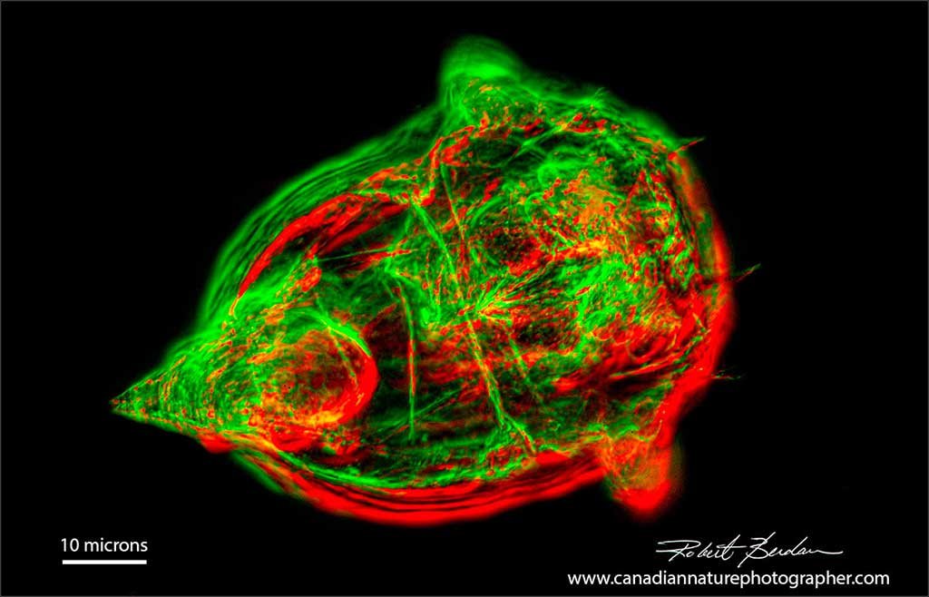 Rotifer Synchaeta Rheinberg &amp; Darkfield