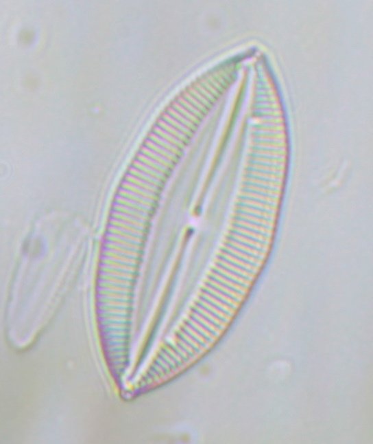 Diatoms_40x_Crop100pc_0125.jpg
