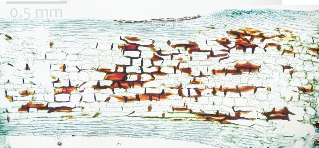 longitudinal section of the pinnae stalk and costa (10x)