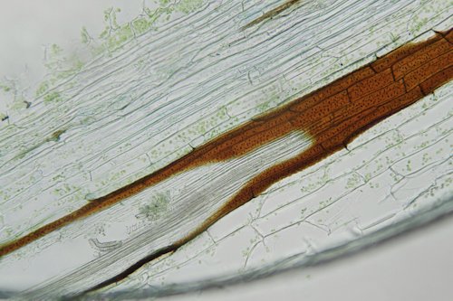 vein with endodermis (brown) and tracheids (20x)