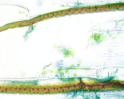 endodermis with pits (40x)