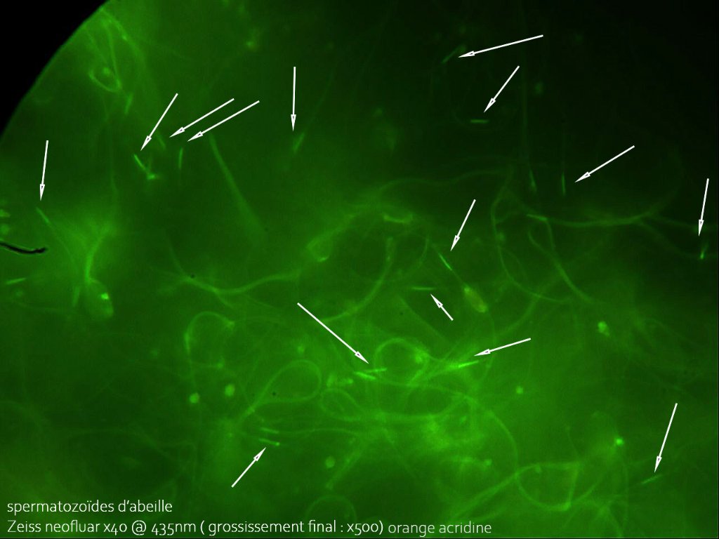 02 spermatozoides abeilles acridine.jpg