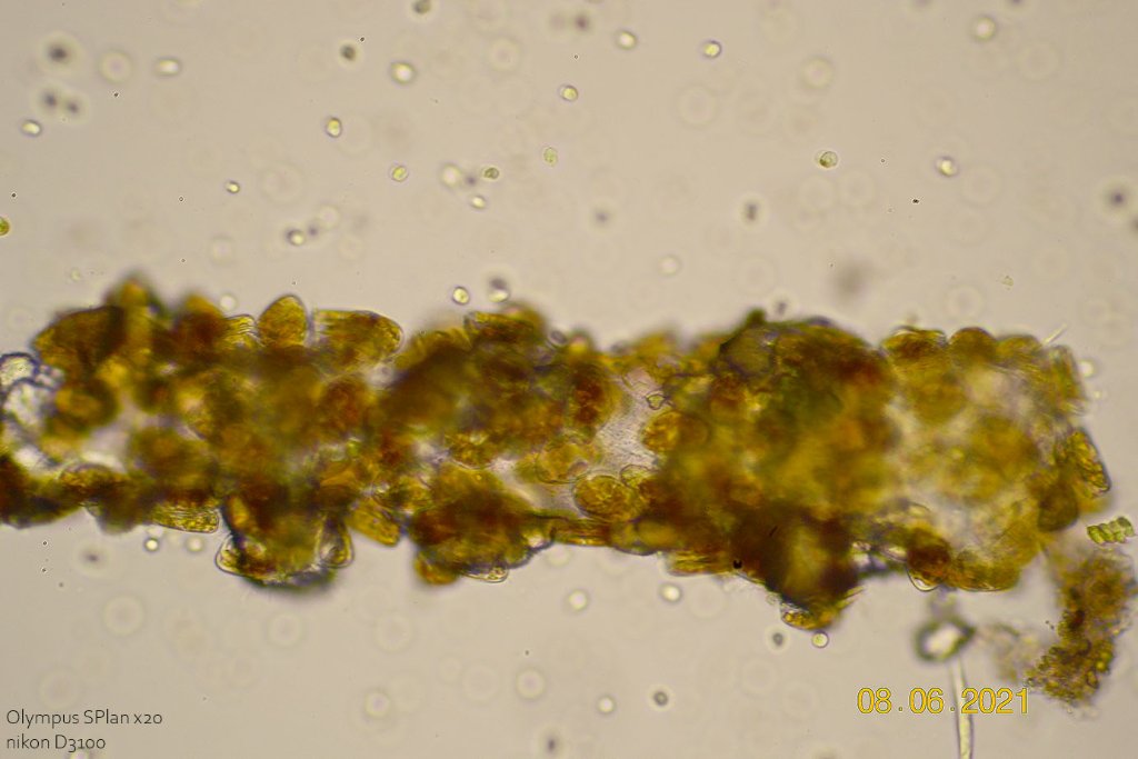 08 juin 21 groupe de diatomée algues.jpg