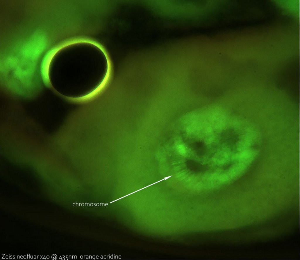 10 juin 21 chironomes chromosomes essai 1 epi.jpg